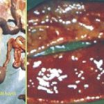 Hiểu biết bệnh nhiễm trùng huyết do Ecoli nguyên phát ở gia cầm cùng big boss